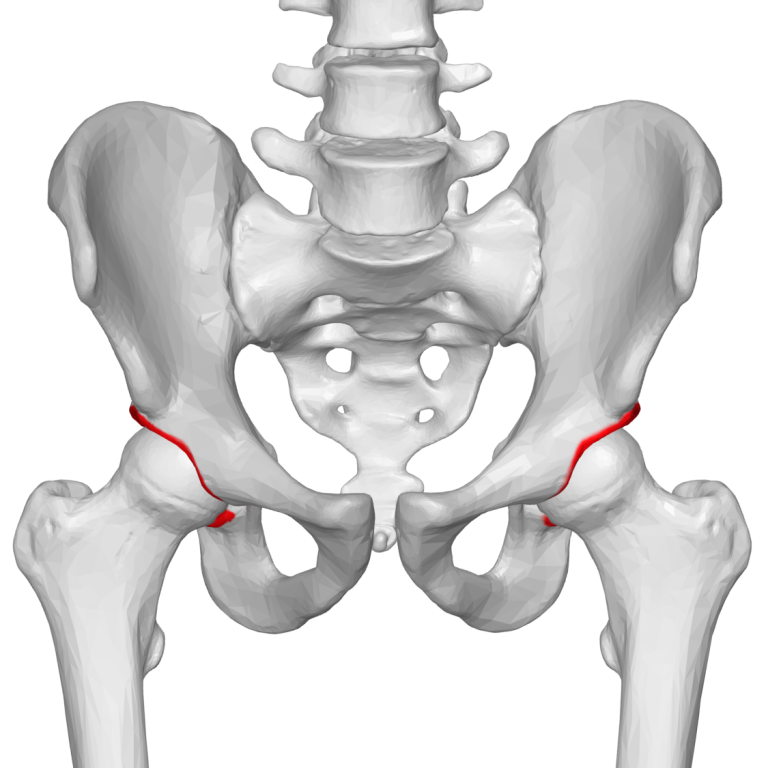 Fracturas acetabulares: causas, síntomas y tratamiento“/&gt;</a></div><div class=