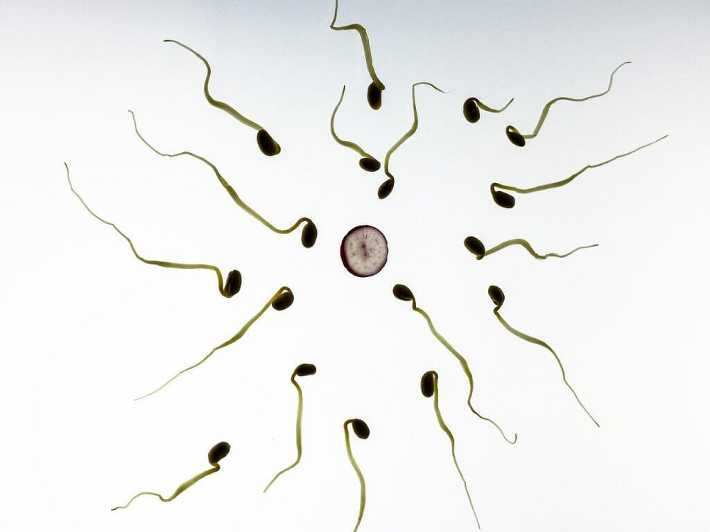 What is Obstructive Azoospermia?