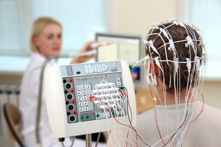 A Guide to an Electroencephalogram Procedure
