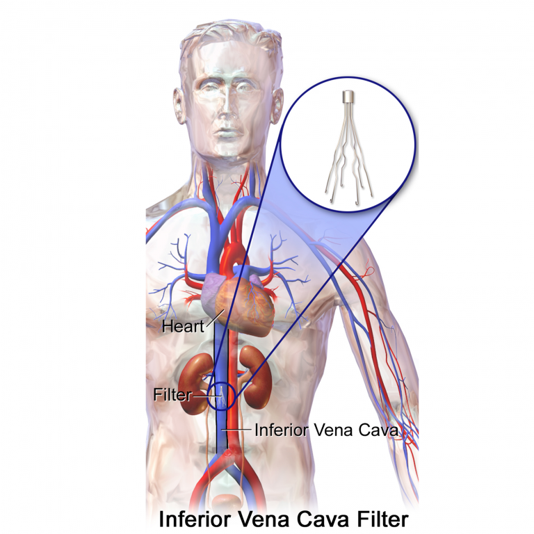 What Is The Inferior Vena Cava?