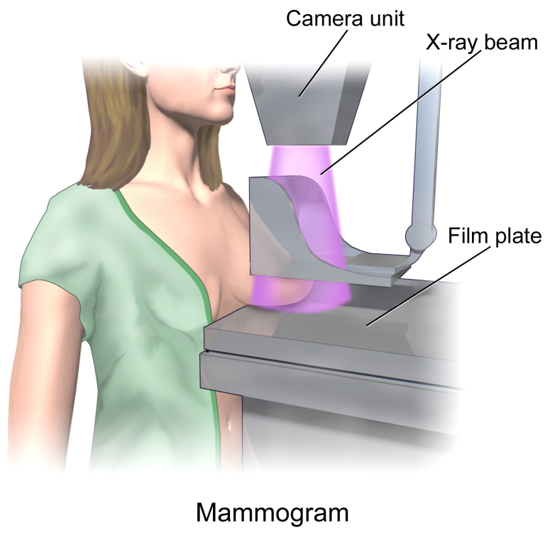 What Is A Mammography?