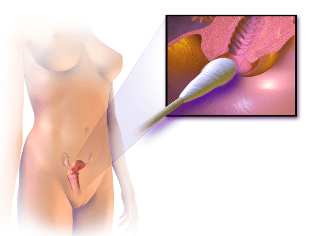 A Guide on a Pap Smear Procedure