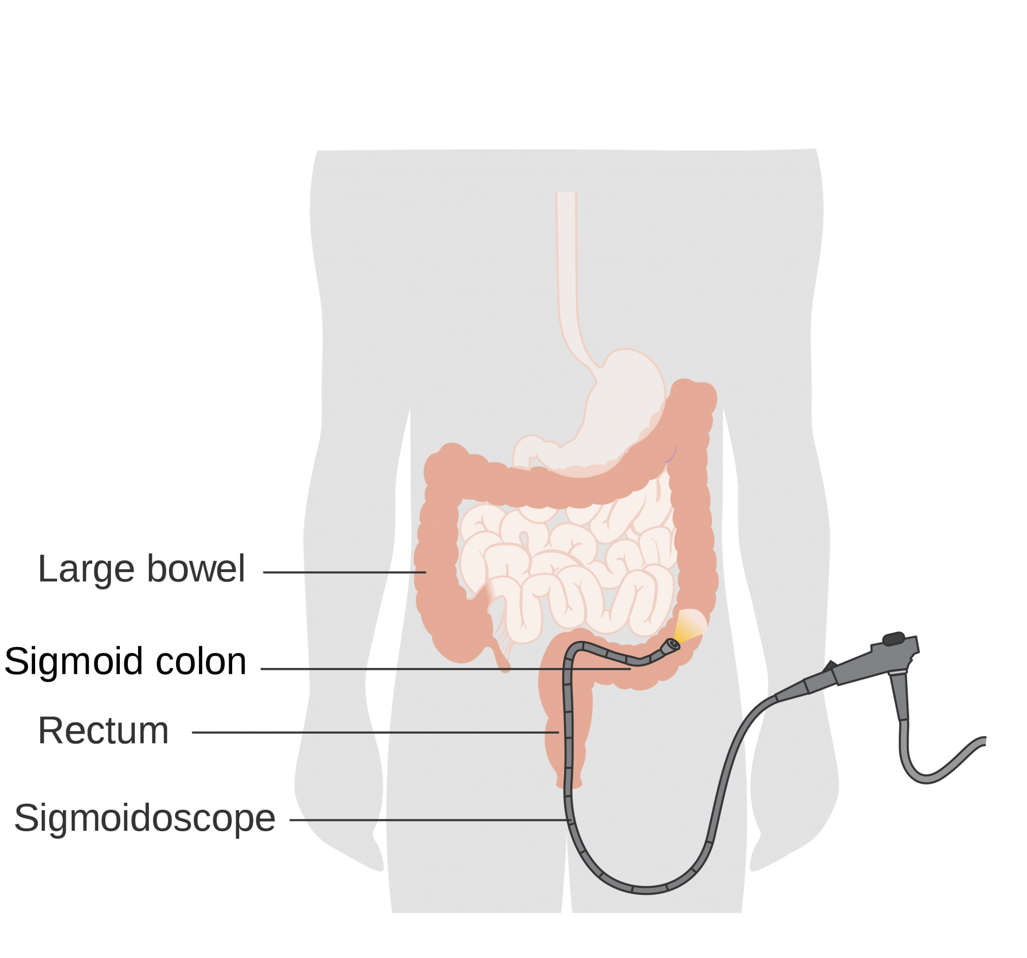 proctoscope Health Literacy Hub