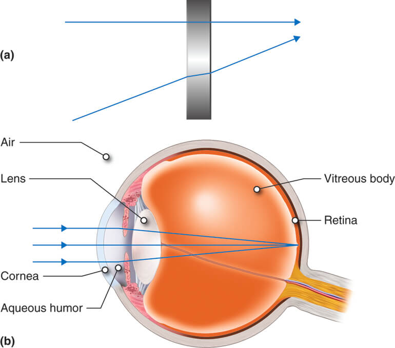 What You Need To Know Before a Vitrectomy
