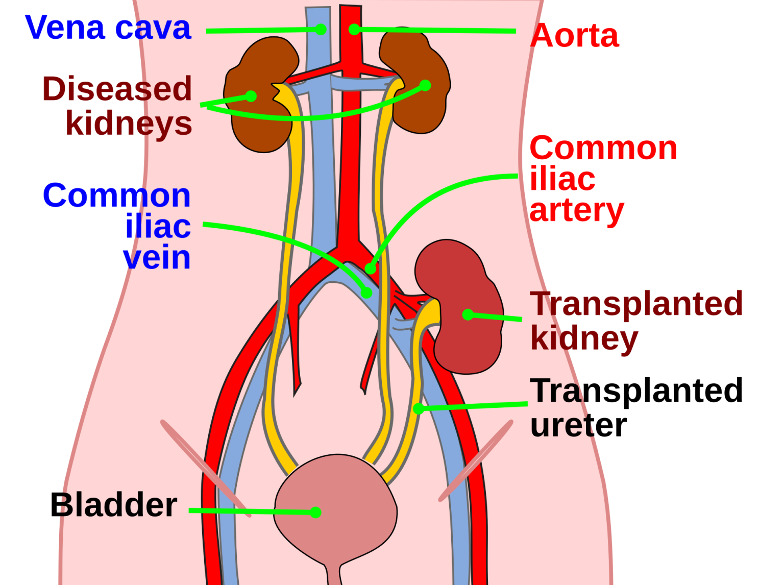 what-i-eat-in-a-day-kidney-transplant-recipient-youtube