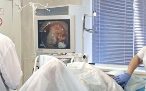 A real life gastroscopy being performed