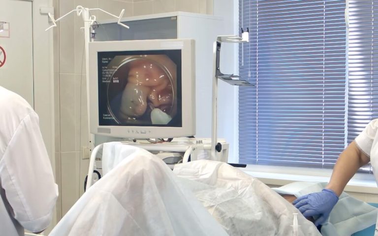 A real life gastroscopy being performed