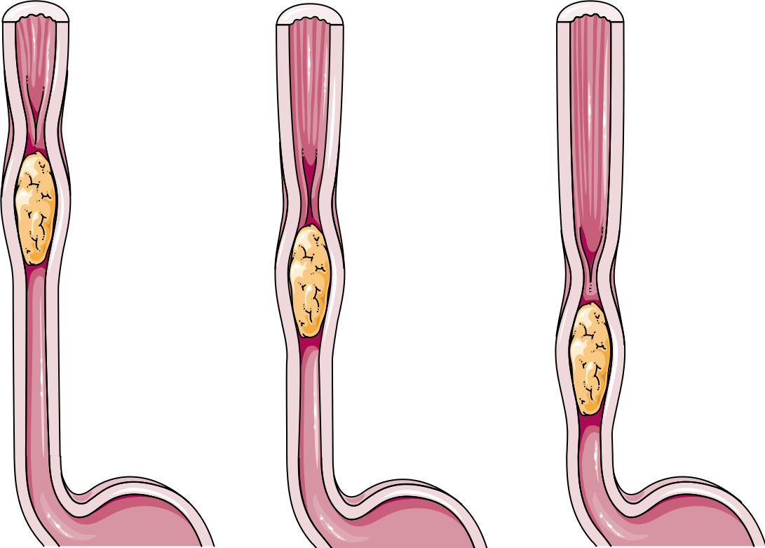 Digestive System Explained - Anatomy 101 For Patients